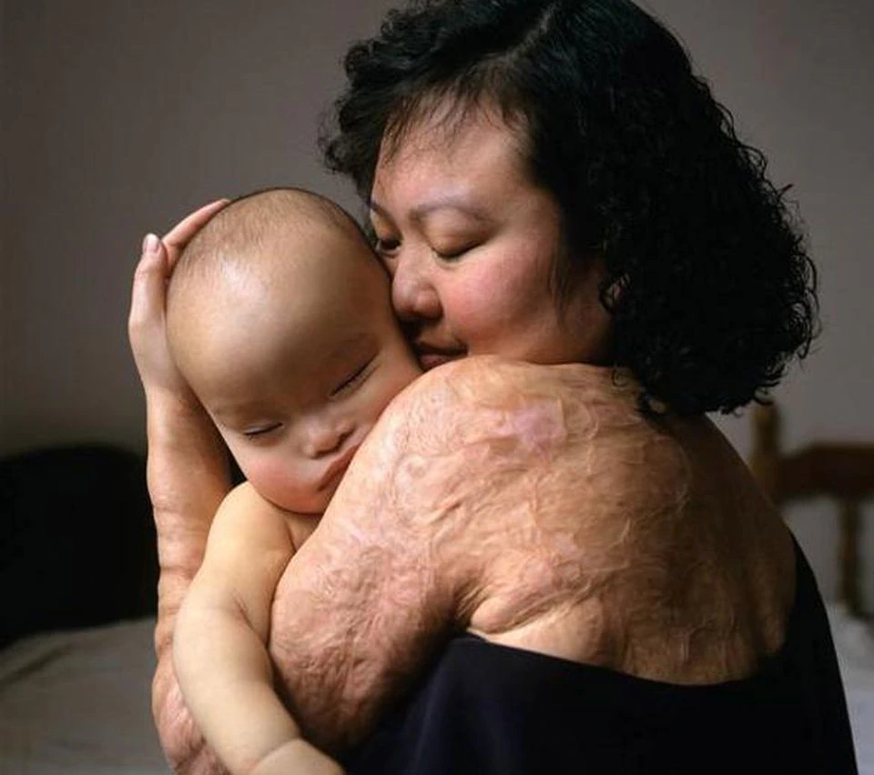 Phan Thi Kim Phuc with Daughter in arms